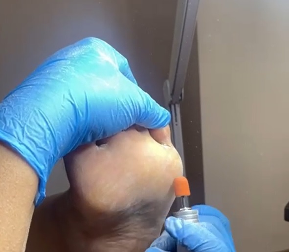 Ayak sağlığı videosu önizleme